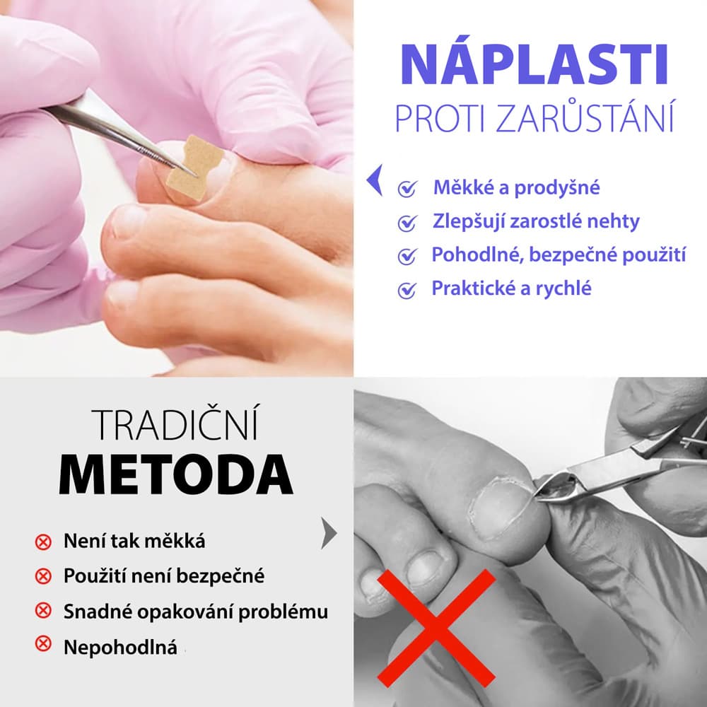 Wellife Náplasti proti zarůstání nehtů 100 ks - náhled 4